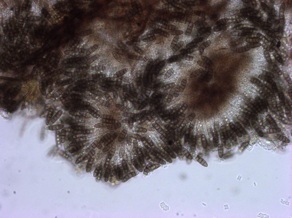 Bactrodesmium cf fraxinii