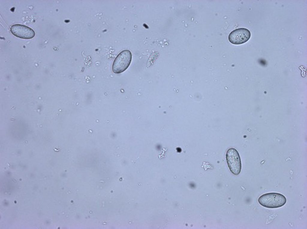 Neofusicoccum cf australe