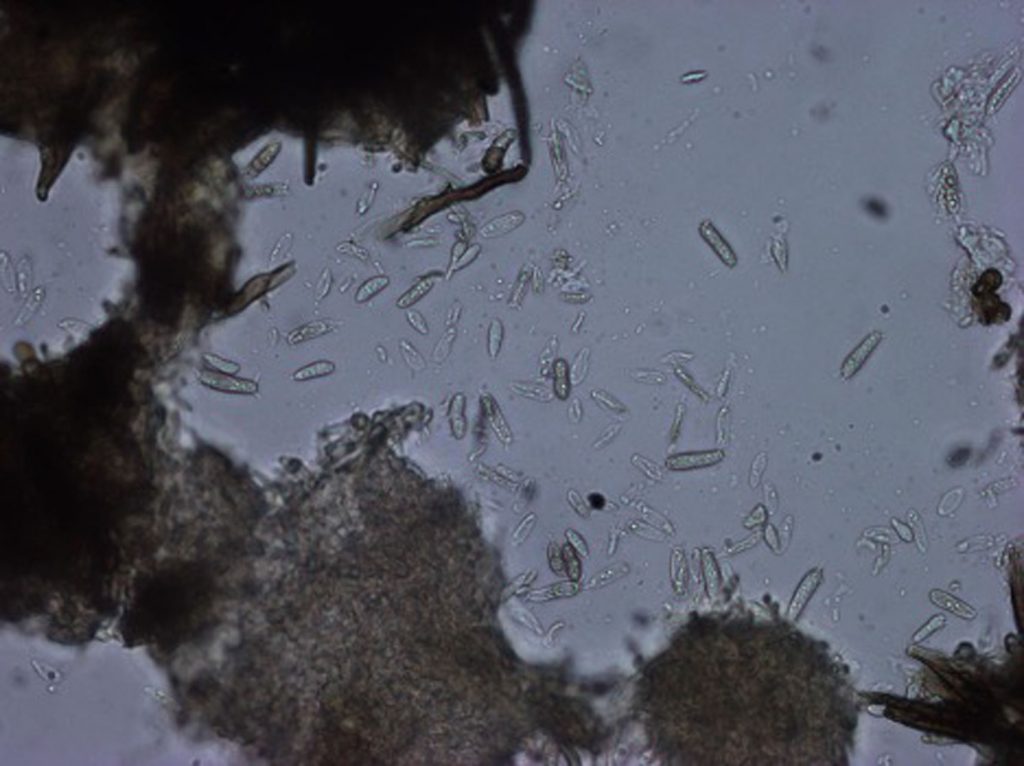Pseudolachnea cf fraxinii