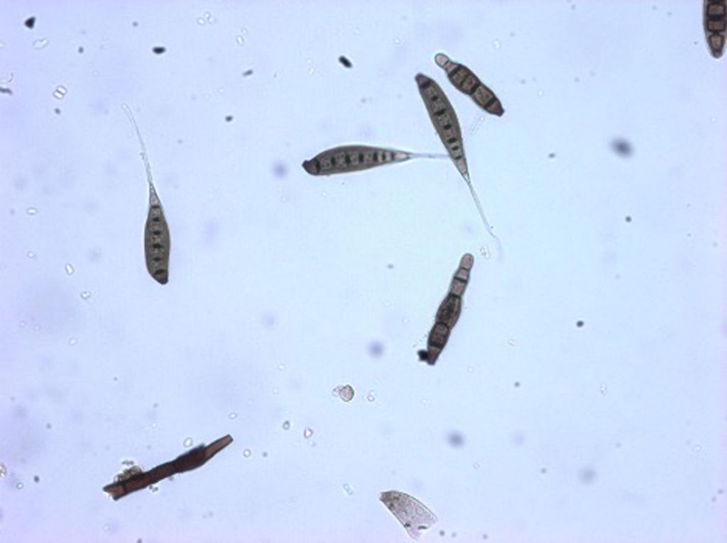 Sporidesmium cf brachypus